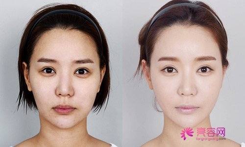 一白遮百丑?!聊聊熟悉又陌生的美白!今天你打美白了吗??