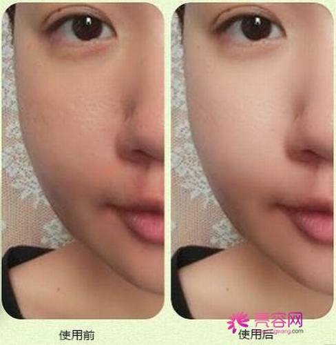 一白遮百丑?!聊聊熟悉又陌生的美白!今天你打美白了吗??