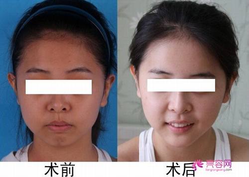 一白遮百丑?!聊聊熟悉又陌生的美白!今天你打美白了吗??