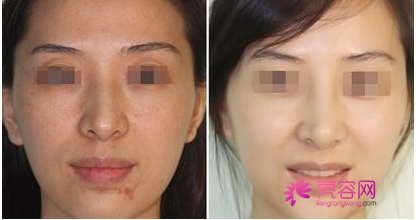 一白遮百丑?!聊聊熟悉又陌生的美白!今天你打美白了吗??