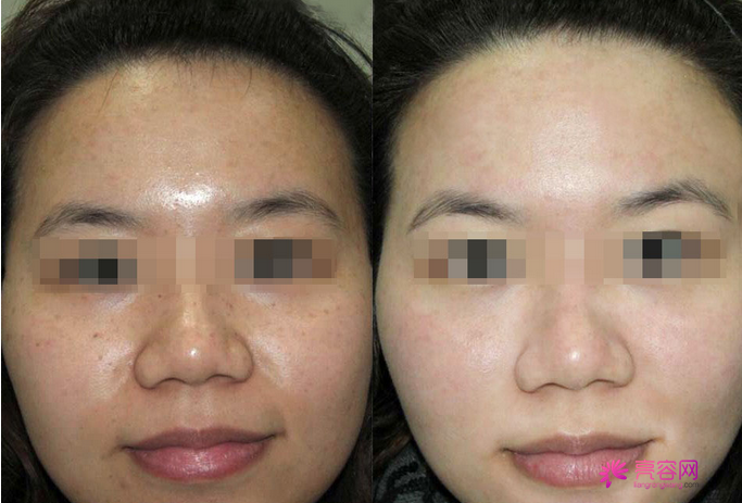 一白遮百丑?!聊聊熟悉又陌生的美白!今天你打美白了吗??