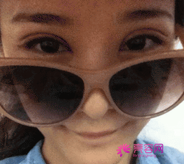 有人问我:埋线双眼皮疼不疼?小编告诉她:仁者见仁,智者见智!