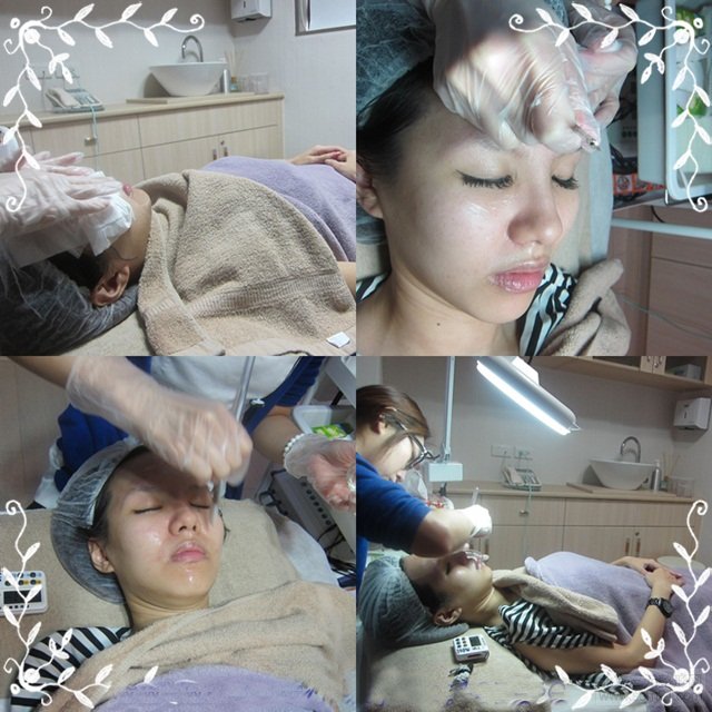 果酸嫩肤治疗中 果酸嫩肤治疗中