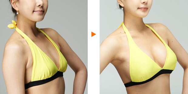 上海时光许黎平隆胸怎么样？