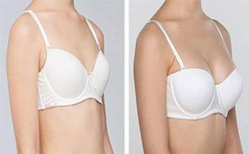 北京东方和谐冯斌做隆胸怎么样？好不好？多少