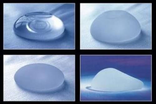 假体隆胸和自体脂肪隆胸