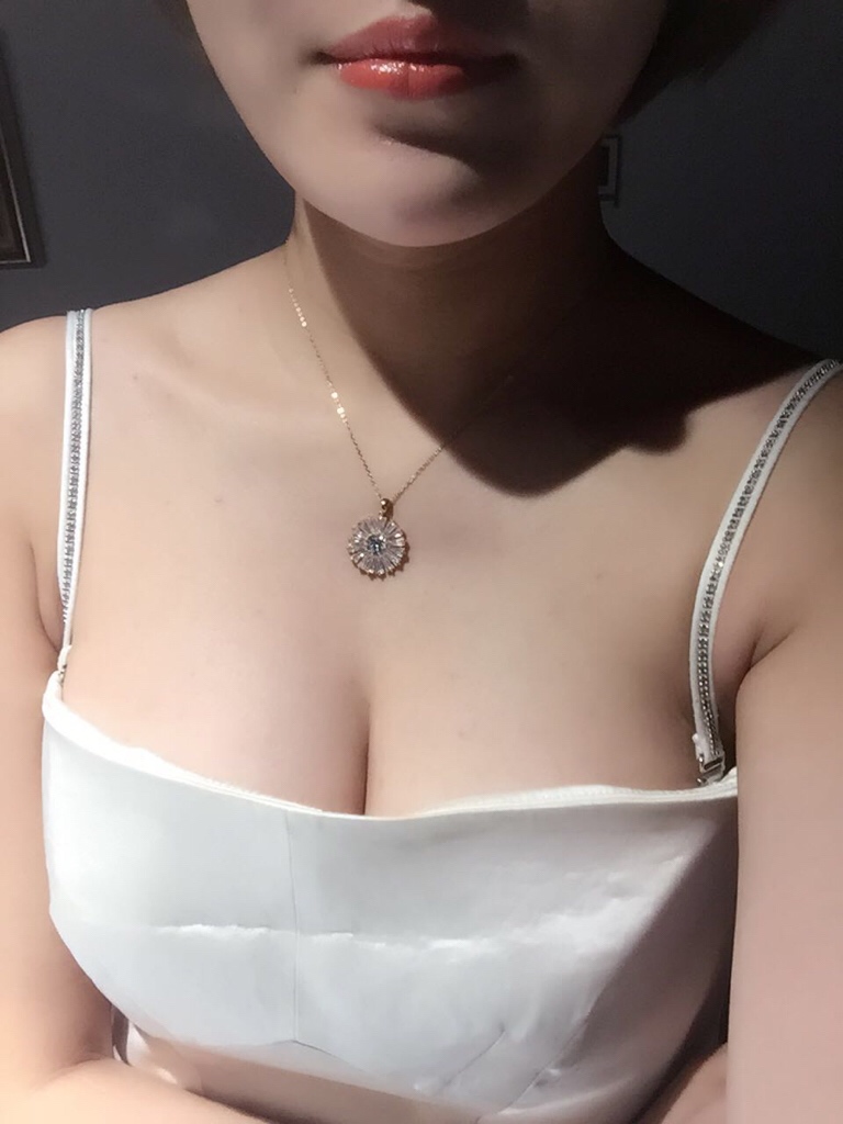 上海九院做假体隆胸的果怎么样？