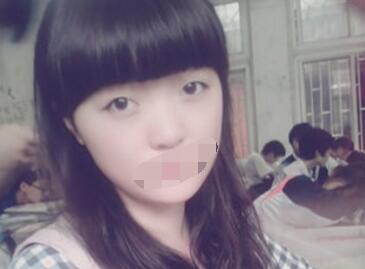 求美者的隆鼻案例!真的美了好多!