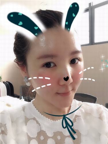 每天福利更新!今日更新的是全脸自体脂肪填充的妹子反馈的真实案例图片分享!来瞧瞧你的自体脂肪做的有咩有她的完美?!小编感觉十分完美!各位拿去羡慕嫉妒吧!不懂欢迎咨询我们哦!