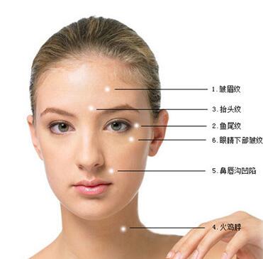 注射瘦脸为什么用来注射鼻唇沟果不是特别好？