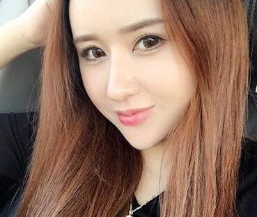 北京沃尔隆鼻案例 什么样的鼻部整形算自然?北京沃尔隆鼻案例