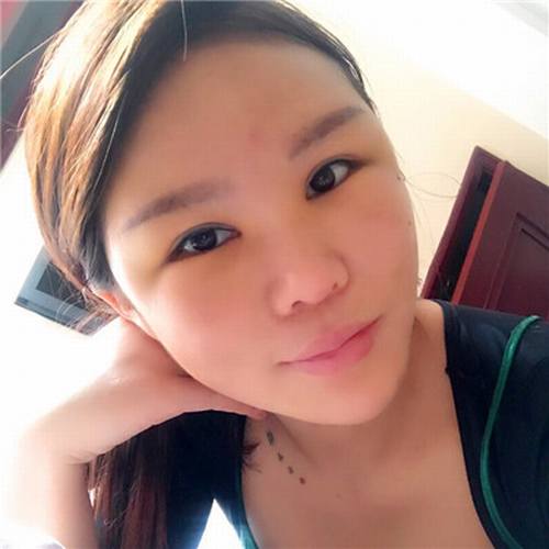 一直都想全脸填充脂肪!全脸几乎都凹陷!苹果肌打过玻尿酸!