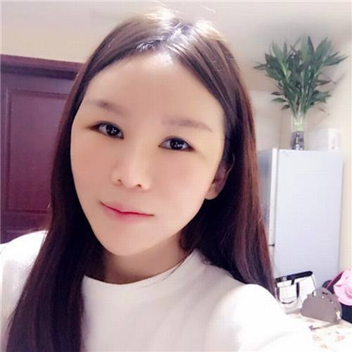 一直都想全脸填充脂肪!全脸几乎都凹陷!苹果肌打过玻尿酸!