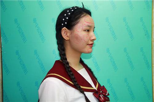 姐妹们较近过的怎么样?哈哈哈,还是让姐妹们看看我的变美案例吧!谁叫我是爱美的人儿呢!姐妹们可不要介意的图多哦!图很多,流量狗不怕的就敬请随意看~~~