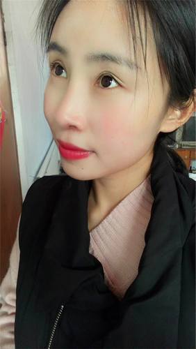 朋友们来看看我的缩鼻翼术后3个月对比照片,你心动了吗?