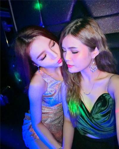上海华美自体软骨隆鼻部手术术后对比照片案例