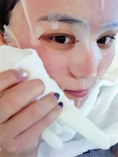 自体血清美肤术后对比照片案例