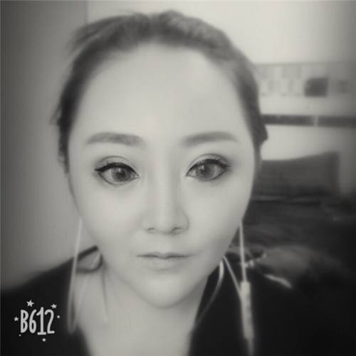 深圳兰乔陈邦胤开外眼角真实案例