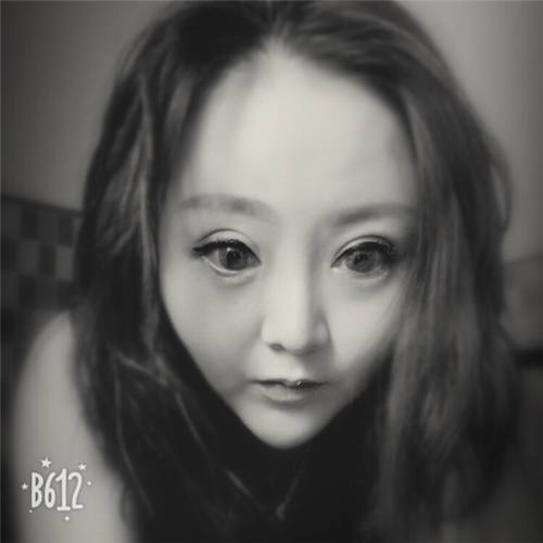 深圳兰乔陈邦胤开外眼角真实案例