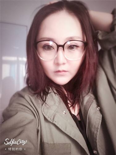 深圳兰乔陈邦胤开外眼角真实案例