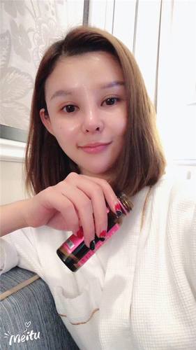 武汉年轻化叶峰眼部修复术前术后对比