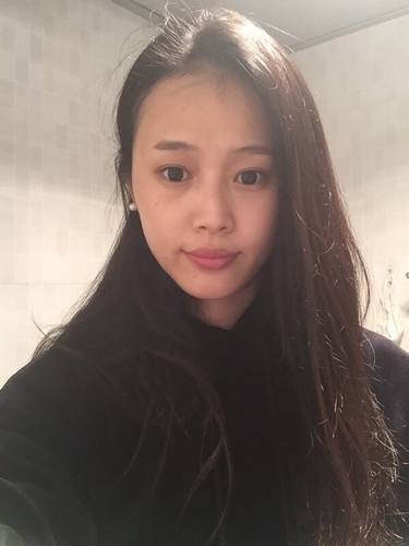 成都玉之光黄开亮鼻部修复对比案例