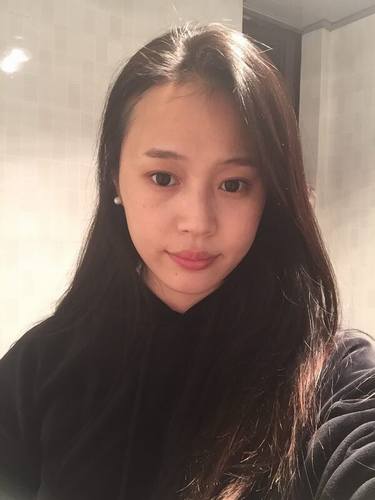 成都玉之光黄开亮鼻部修复对比案例