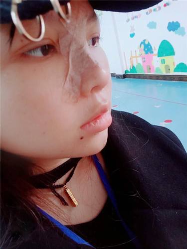 武汉洪山爱美汇瞿敏鼻部手术案例分享