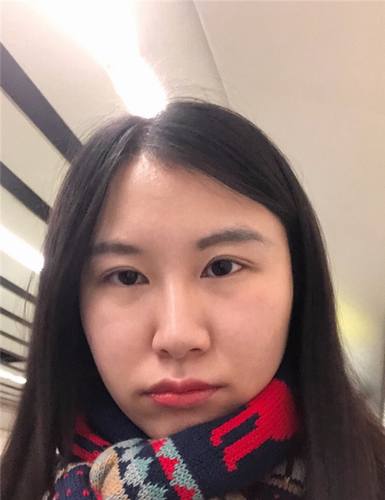 北京清木石晓川自体脂肪全脸填充