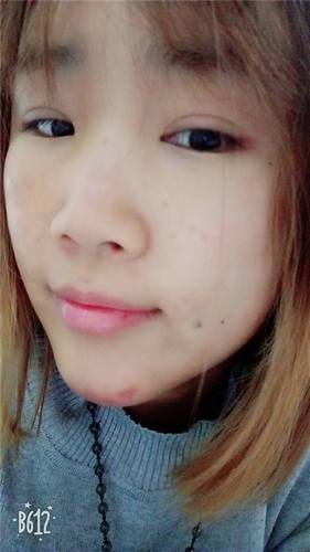 成都驻颜宋莉萍自体脂肪填充脸部