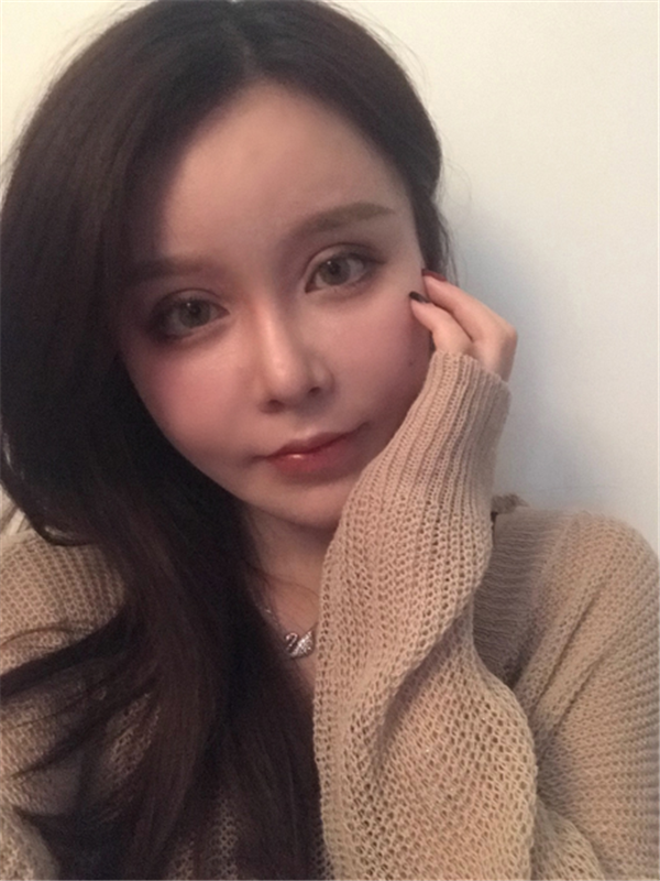 武汉希思特杨权明眼部综合