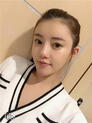 武汉韩辰自体脂肪全脸填充案例