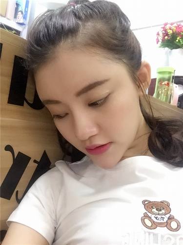 武汉韩辰自体脂肪全脸填充案例