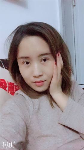 我终于有双眼皮啦!!眼睛变得炯炯有神了~~这个圣诞节可以美美的过了哈哈~~~