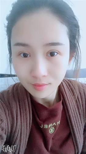 我终于有双眼皮啦!!眼睛变得炯炯有神了~~这个圣诞节可以美美的过了哈哈~~~
