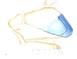 鼻整形中常说的自体软骨有哪些?