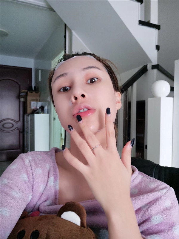 宝宝们看过来,分享我的双眼皮全切变美经历啦!!!很多人都说没有看出来我是做的,完美!