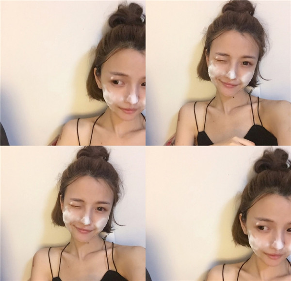 我的自体脂肪填充脸部案例,小姐姐们进来看看吧!2018年改变自己从脸开始哦~~美照很多,哈哈现在再也不怕拍照了~~~