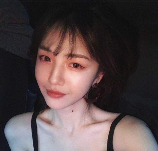 我的自体脂肪填充脸部案例,小姐姐们进来看看吧!2018年改变自己从脸开始哦~~美照很多,哈哈现在再也不怕拍照了~~~