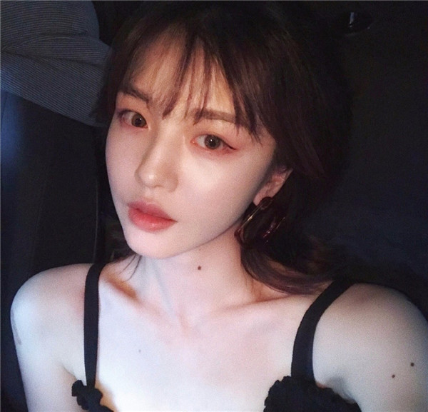 我的自体脂肪填充脸部案例,小姐姐们进来看看吧!2018年改变自己从脸开始哦~~美照很多,哈哈现在再也不怕拍照了~~~