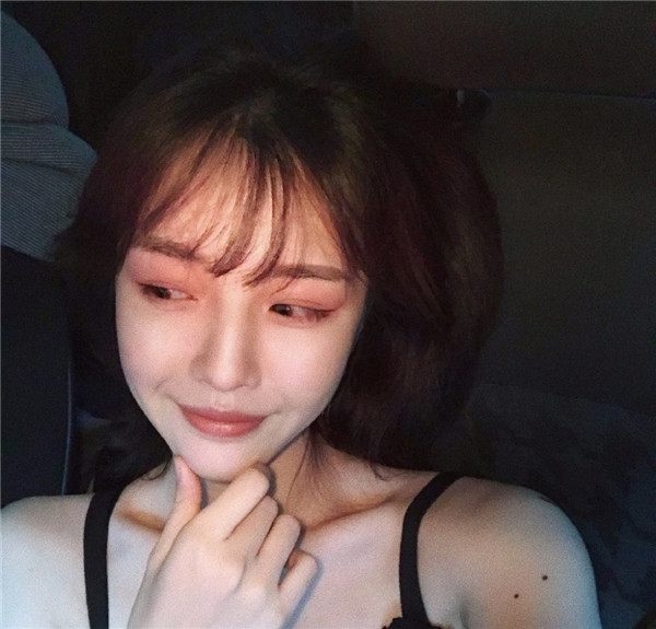 我的自体脂肪填充脸部案例,小姐姐们进来看看吧!2018年改变自己从脸开始哦~~美照很多,哈哈现在再也不怕拍照了~~~