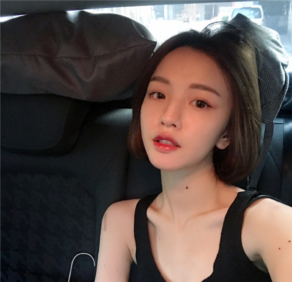 我的自体脂肪填充脸部案例,小姐姐们进来看看吧!2018年改变自己从脸开始哦~~美照很多,哈哈现在再也不怕拍照了~~~