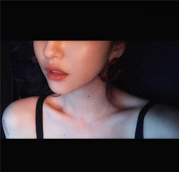 我的自体脂肪填充脸部案例,小姐姐们进来看看吧!2018年改变自己从脸开始哦~~美照很多,哈哈现在再也不怕拍照了~~~