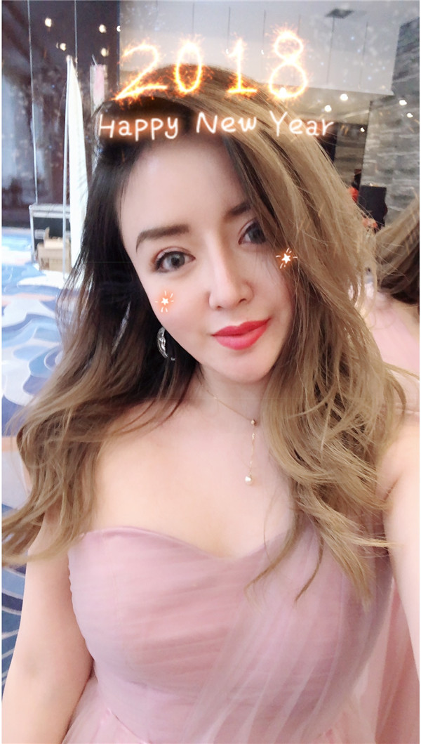 知道什么是睑缘微创吗?快进来看看我的双眼皮案例,术后不会有疤痕哦!!!