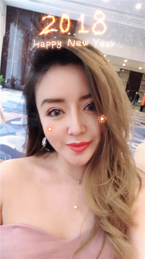 知道什么是睑缘微创吗?快进来看看我的双眼皮案例,术后不会有疤痕哦!!!