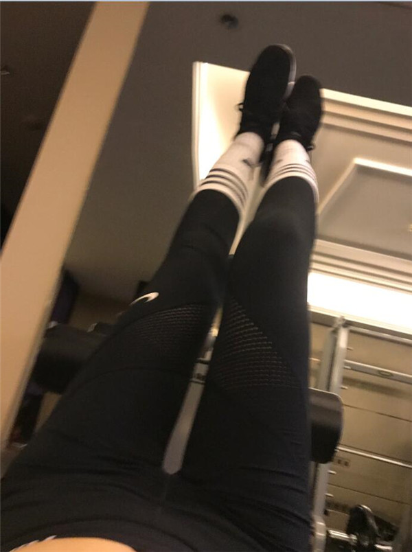 姐妹们,给你们看看我的大腿吸脂案例!!恢复的挺好,快来看看我的一双筷子腿,瘦瘦的腿真好