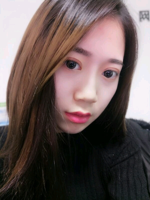 姐妹们,都来看看我的案例吧!!以前内双的眼皮晚上喝水喝得多第二天眼睛都会肿很久,现在拥有双眼皮之后再也不用担心了~~~
