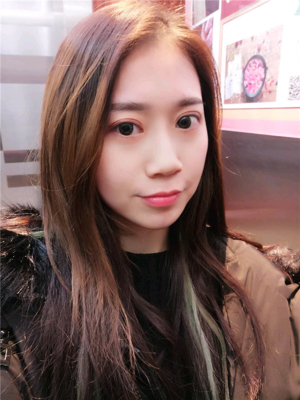 姐妹们,都来看看我的案例吧!!以前内双的眼皮晚上喝水喝得多第二天眼睛都会肿很久,现在拥有双眼皮之后再也不用担心了~~~