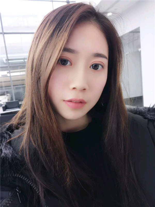 姐妹们,都来看看我的案例吧!!以前内双的眼皮晚上喝水喝得多第二天眼睛都会肿很久,现在拥有双眼皮之后再也不用担心了~~~