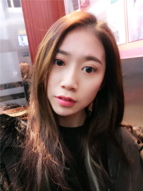 姐妹们,都来看看我的案例吧!!以前内双的眼皮晚上喝水喝得多第二天眼睛都会肿很久,现在拥有双眼皮之后再也不用担心了~~~